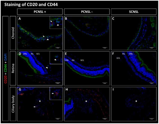 CD44 Antibody in Immunohistochemistry (IHC)