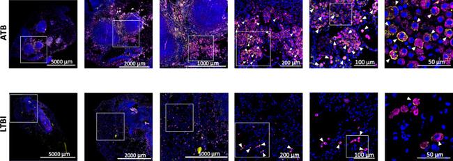 MX1 Antibody in Immunohistochemistry (IHC)