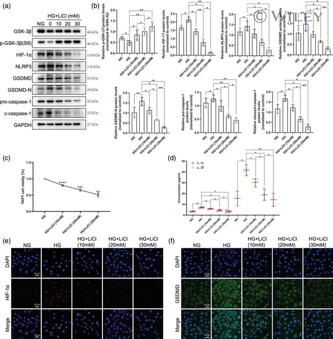 GSDMD Antibody in Immunocytochemistry (ICC/IF)