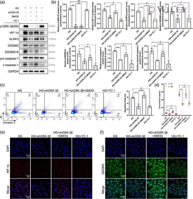 GSDMD Antibody in Immunocytochemistry (ICC/IF)