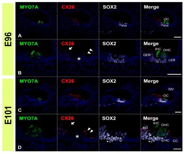 Connexin 26 Antibody in Immunohistochemistry (IHC)