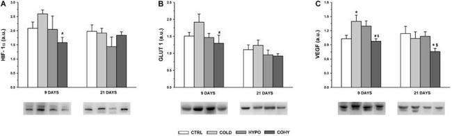 VEGF Antibody in Western Blot (WB)