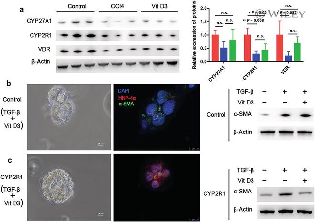 VDR Antibody in Western Blot (WB)