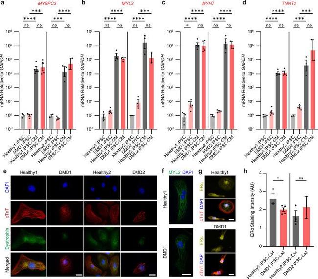 Estrogen Receptor alpha Antibody in Immunocytochemistry (ICC/IF)