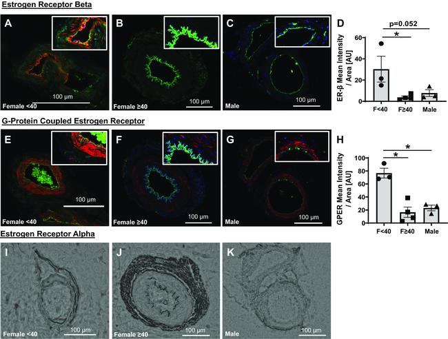 Estrogen Receptor alpha Antibody in Immunohistochemistry (IHC)