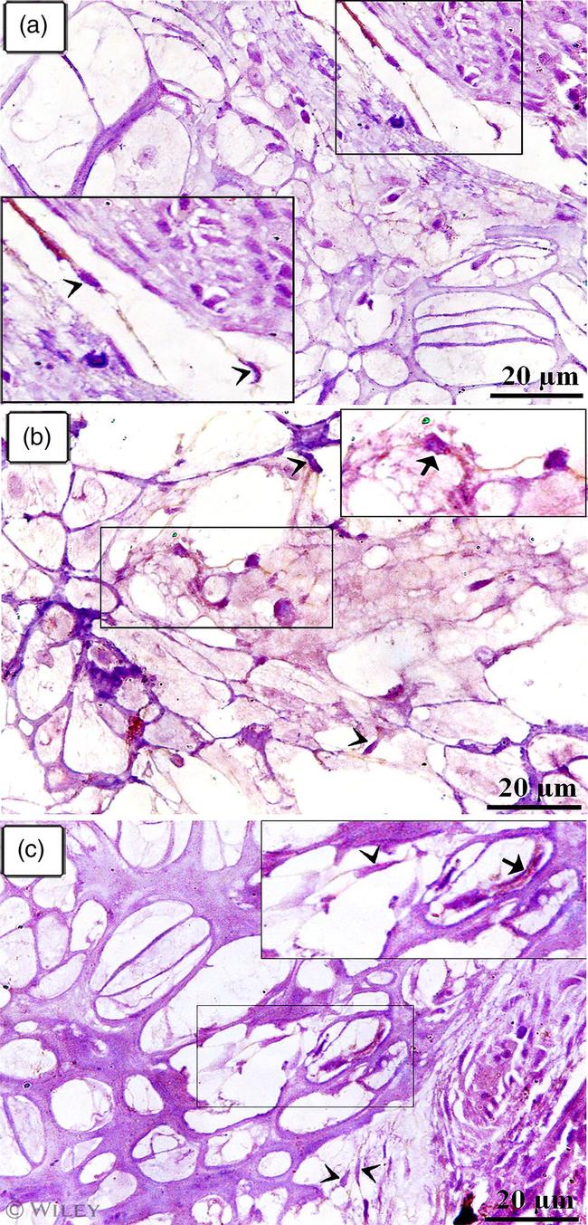 CD117 (c-Kit) Antibody in Immunohistochemistry (Paraffin) (IHC (P))