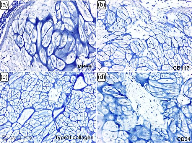 CD117 (c-Kit) Antibody in Immunohistochemistry (Paraffin) (IHC (P))