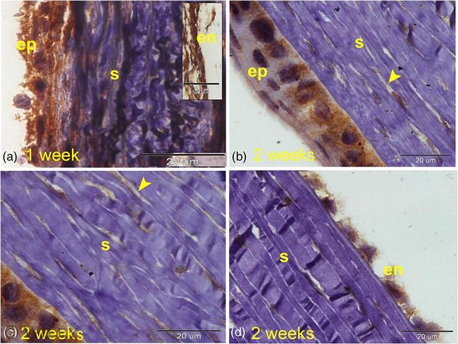 VEGF Antibody in Immunohistochemistry (IHC)