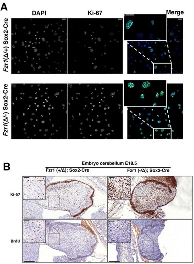 Ki-67 Antibody in Immunocytochemistry, Immunohistochemistry (ICC/IF, IHC)