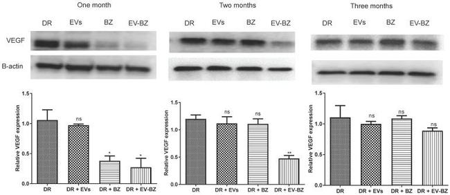 VEGF Antibody in Western Blot (WB)