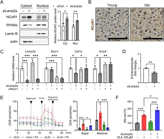 NCoR1 Antibody in Immunohistochemistry (Paraffin) (IHC (P))