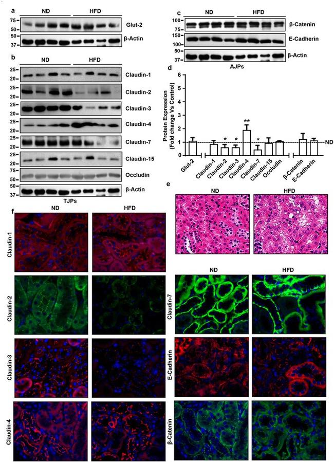 Claudin 1 Antibody in Immunohistochemistry (IHC)