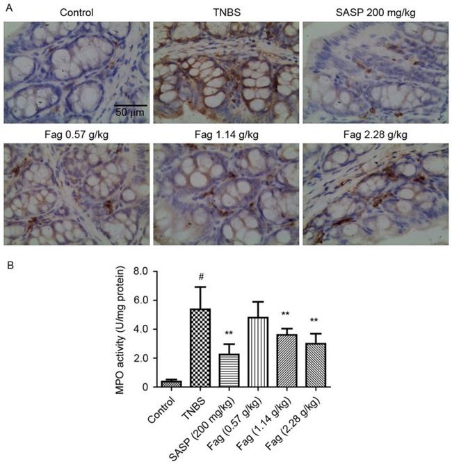 F4/80 Antibody in Immunohistochemistry, Immunohistochemistry (Paraffin) (IHC, IHC (P))