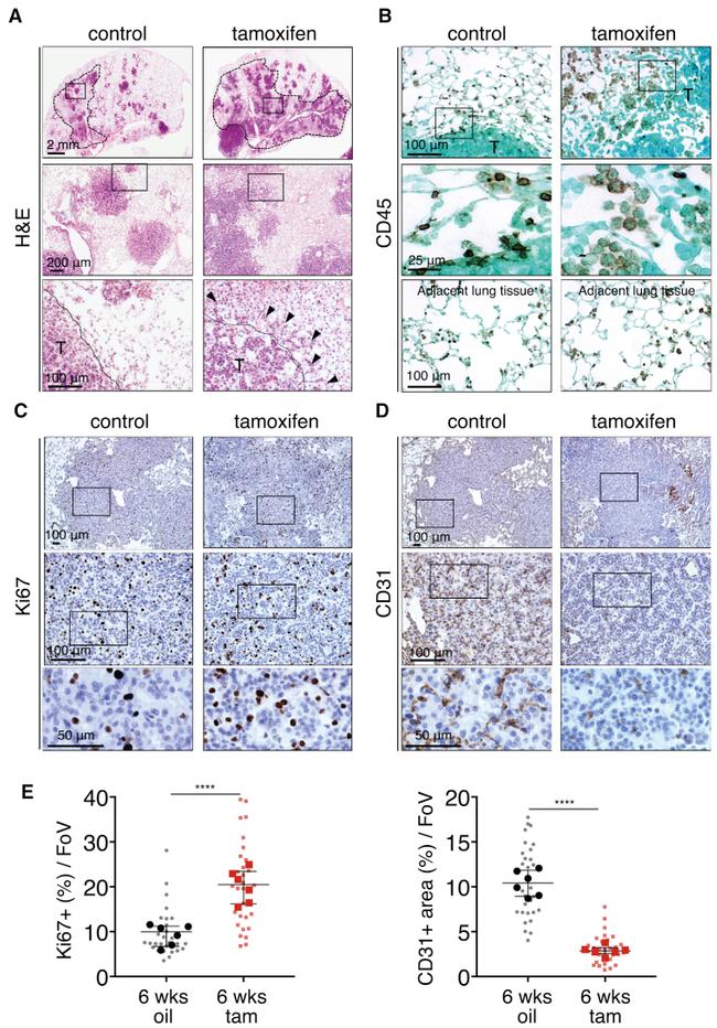 CD45 Antibody in Immunohistochemistry (IHC)