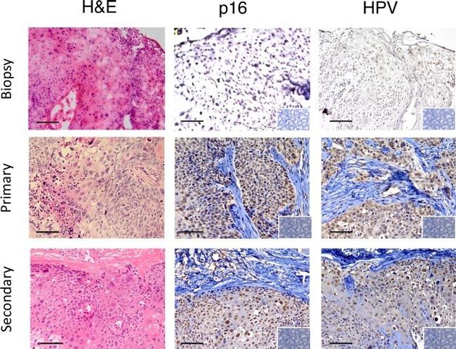 CD45 Antibody in Immunohistochemistry (IHC)