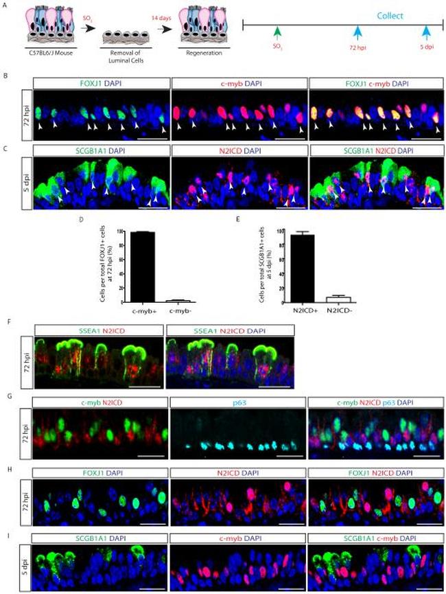 FOXJ1 Antibody in Immunohistochemistry (IHC)