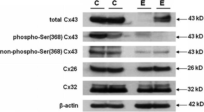 Connexin 26 Antibody in Western Blot (WB)