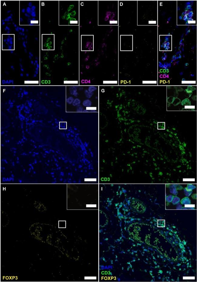 FOXP3 Antibody in Immunohistochemistry (IHC)