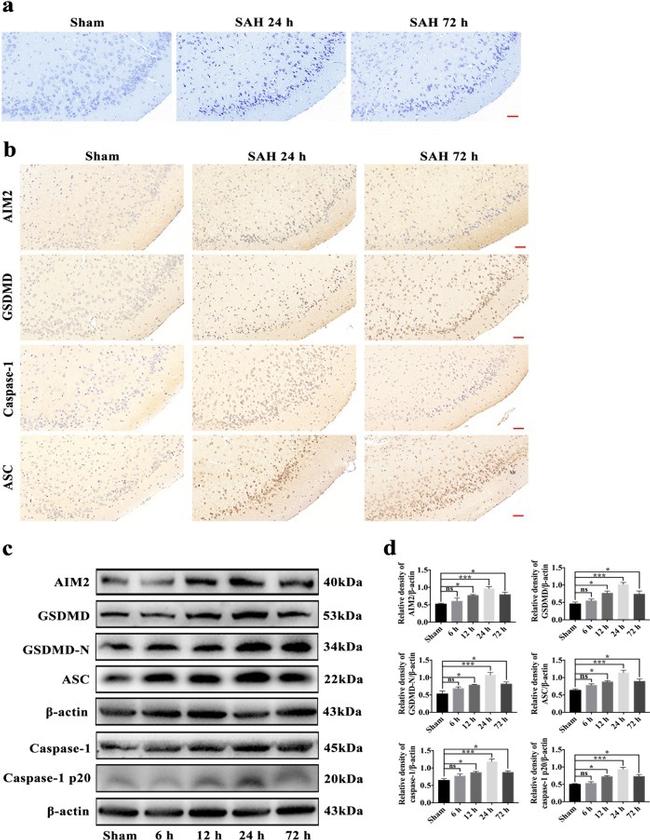 AIM2 Antibody in Western Blot, Immunohistochemistry (WB, IHC)