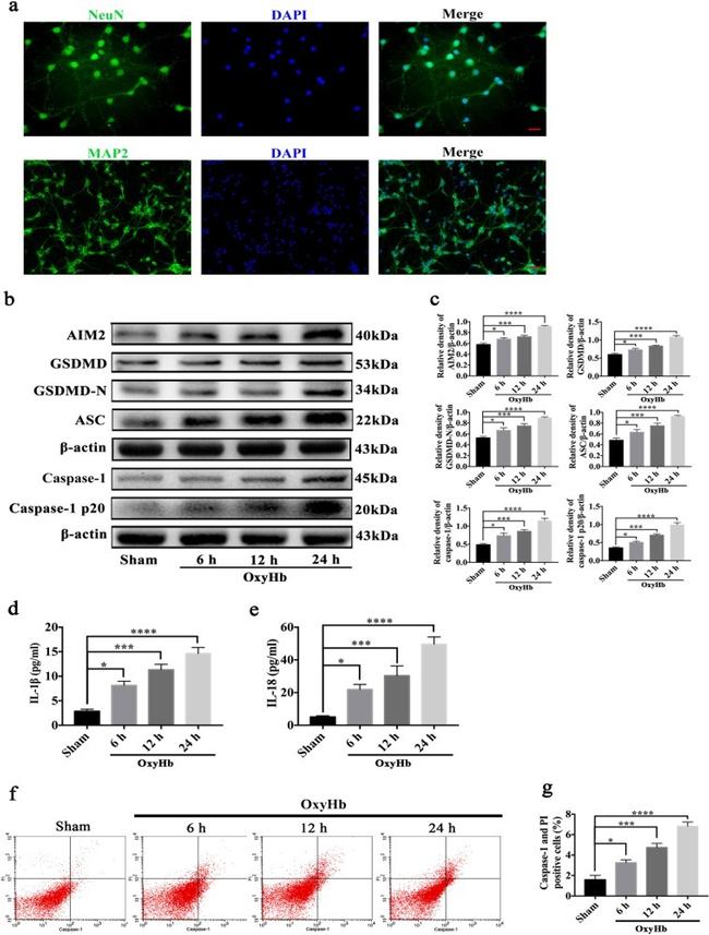 AIM2 Antibody in Western Blot (WB)