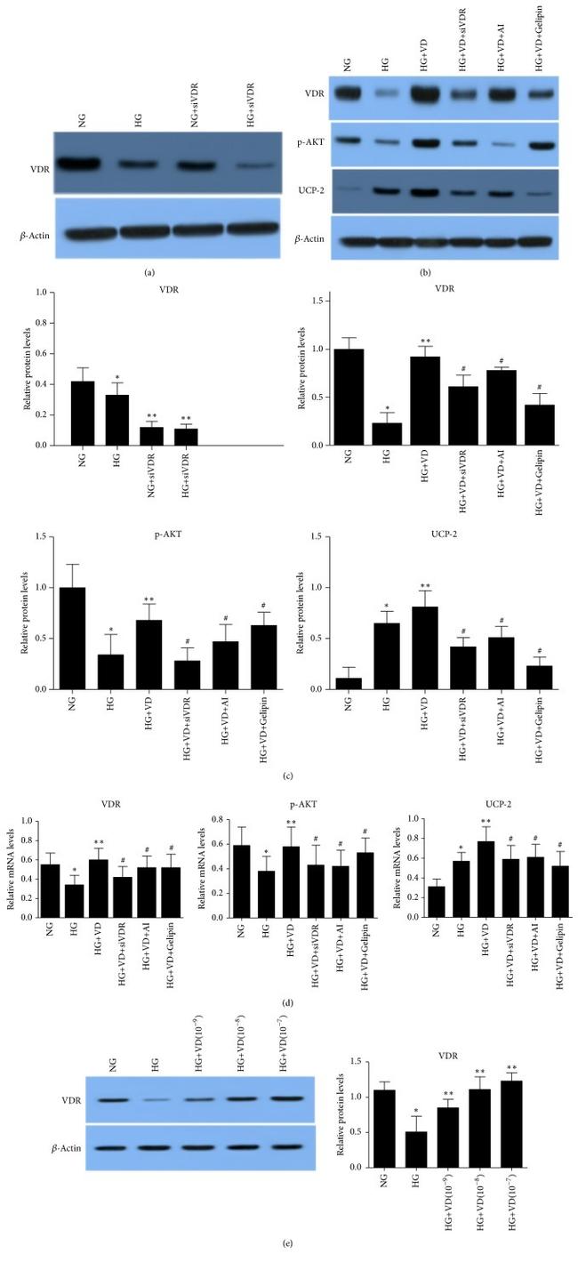 VDR Antibody in Western Blot (WB)