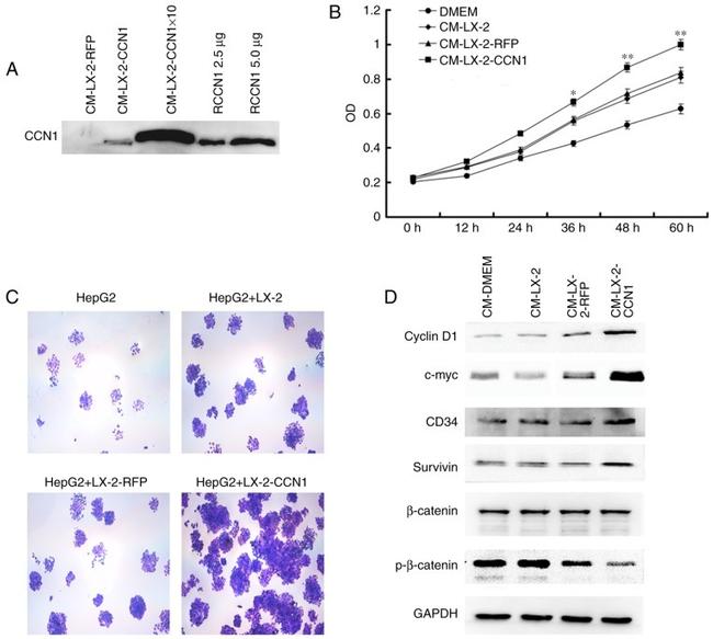 c-Myc Antibody in Western Blot (WB)