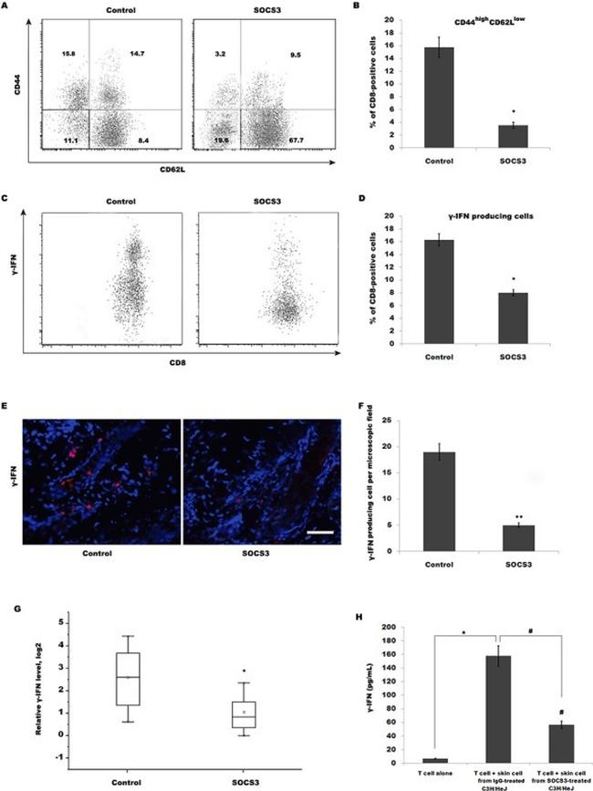 CD44 Antibody