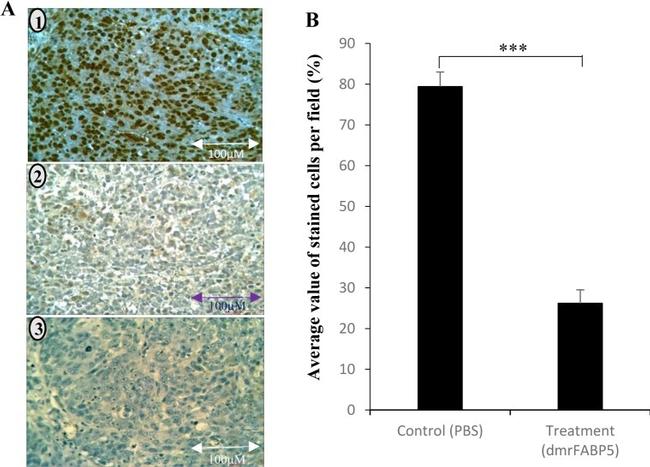 Phospho-PPAR gamma (Ser112) Antibody in Immunocytochemistry, Immunohistochemistry (ICC/IF, IHC)