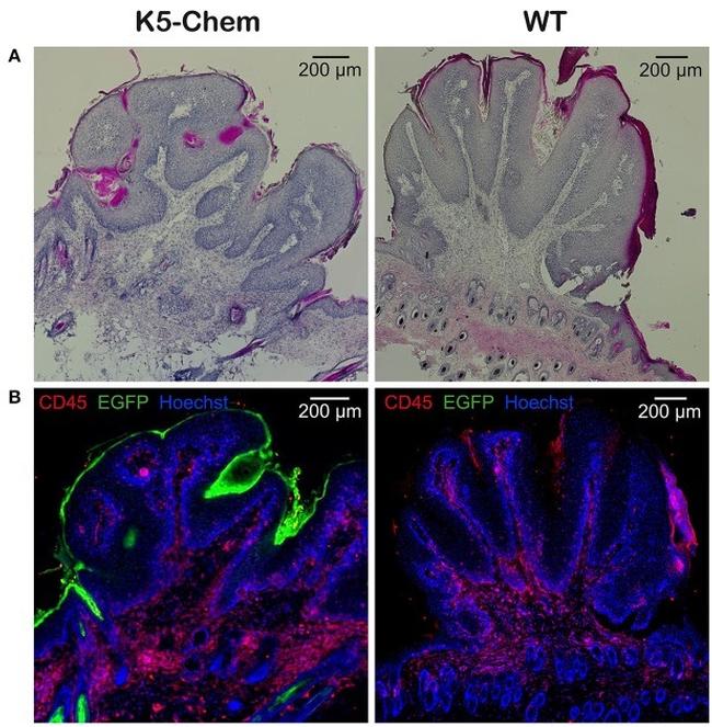 CD45 Antibody in Immunohistochemistry (IHC)