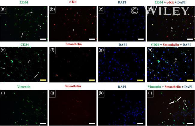 CD117 (c-Kit) Antibody in Immunocytochemistry (ICC/IF)