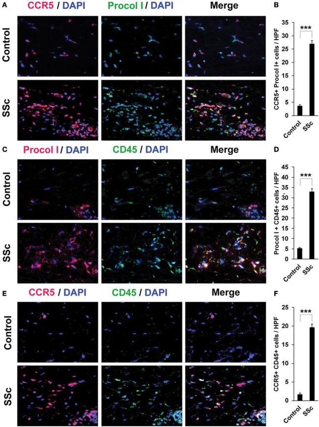 CD45 Antibody in Immunohistochemistry (IHC)