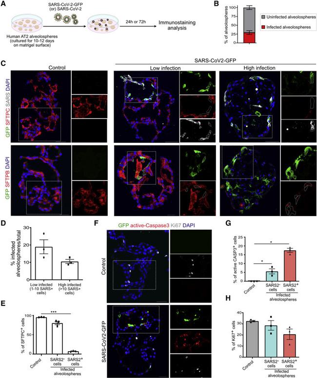 Ki-67 Antibody in Immunocytochemistry (ICC/IF)