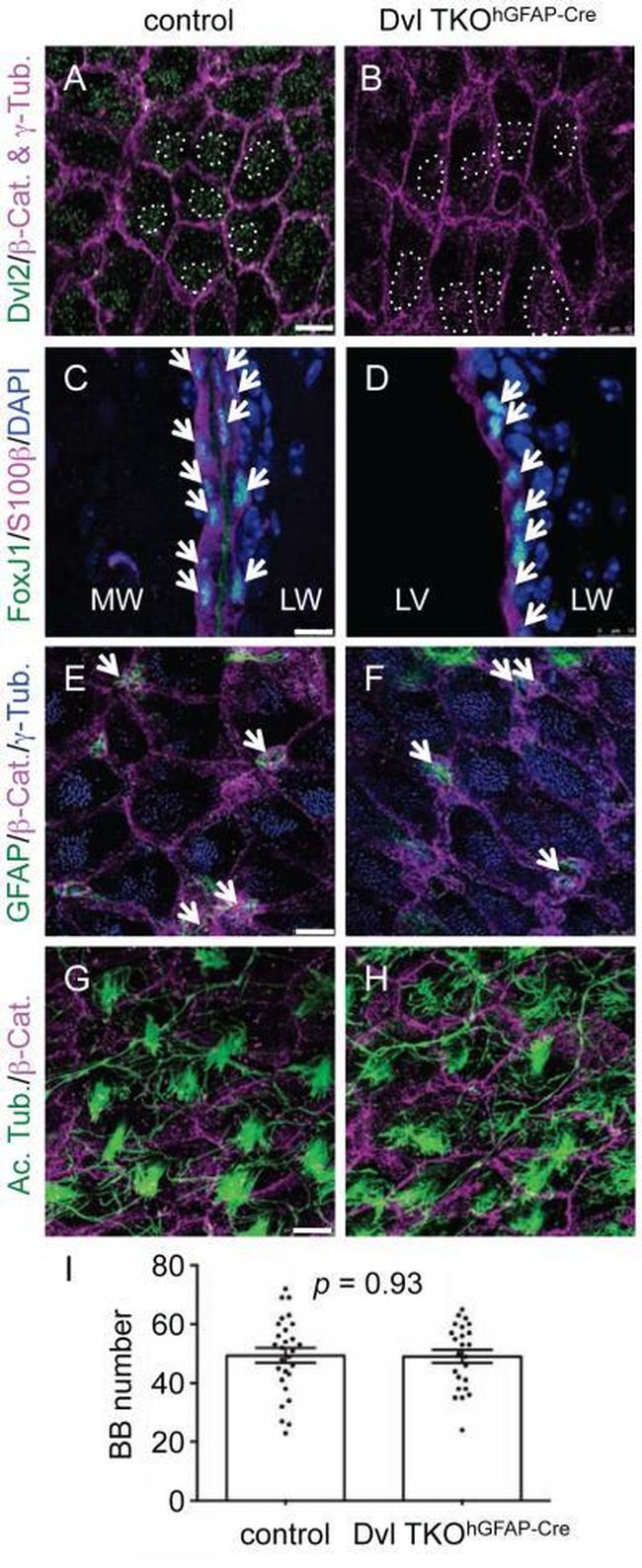 FOXJ1 Antibody in Immunohistochemistry (IHC)