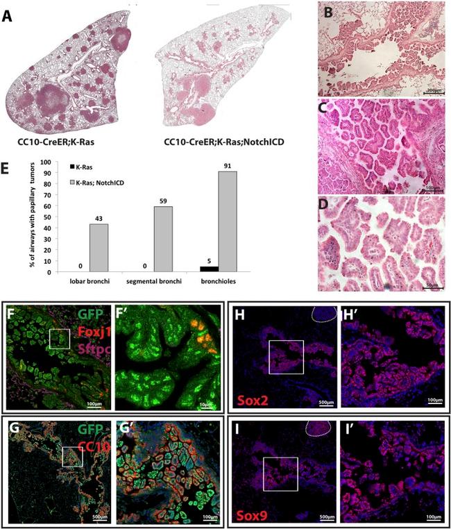 FOXJ1 Antibody in Immunohistochemistry (IHC)