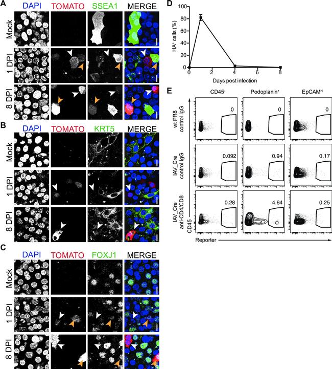 FOXJ1 Antibody in Immunocytochemistry (ICC/IF)