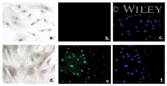 VDR Antibody in Immunocytochemistry (ICC/IF)