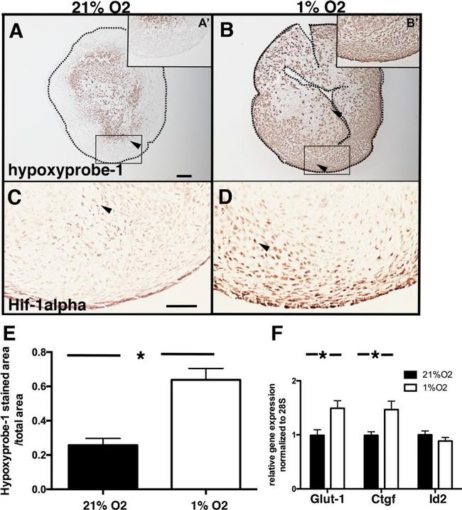 HIF1A Antibody in Immunohistochemistry (IHC)