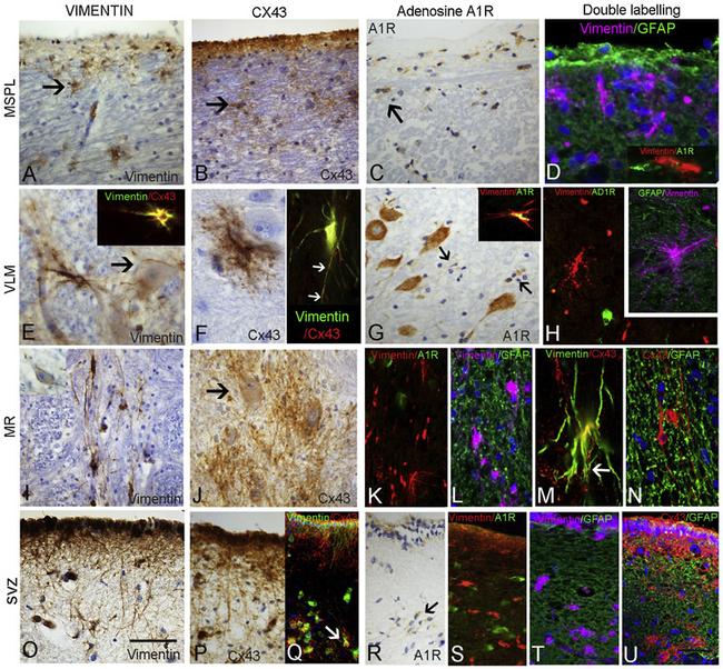 Connexin 26 Antibody in Immunohistochemistry (IHC)